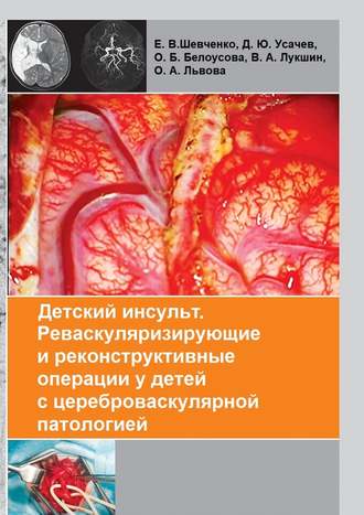 Коллектив авторов, Детский инсульт. Реваскуляризирующие и реконструктивные операции у детей с цереброваскулярной патологией